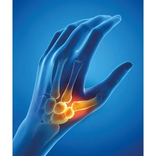 Orthèse pouce gauche Epitact®